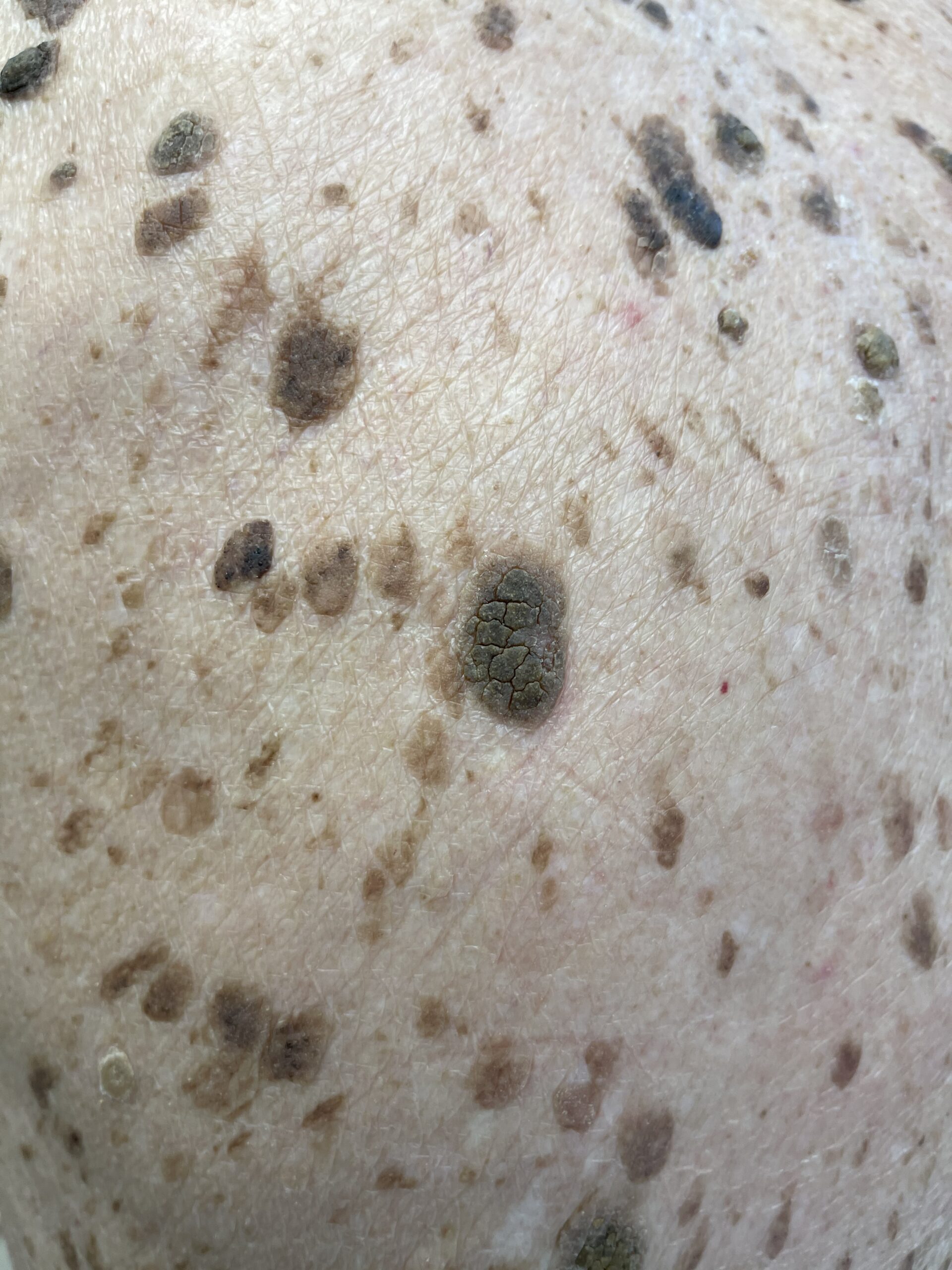 Close view showing differences in surface texture.