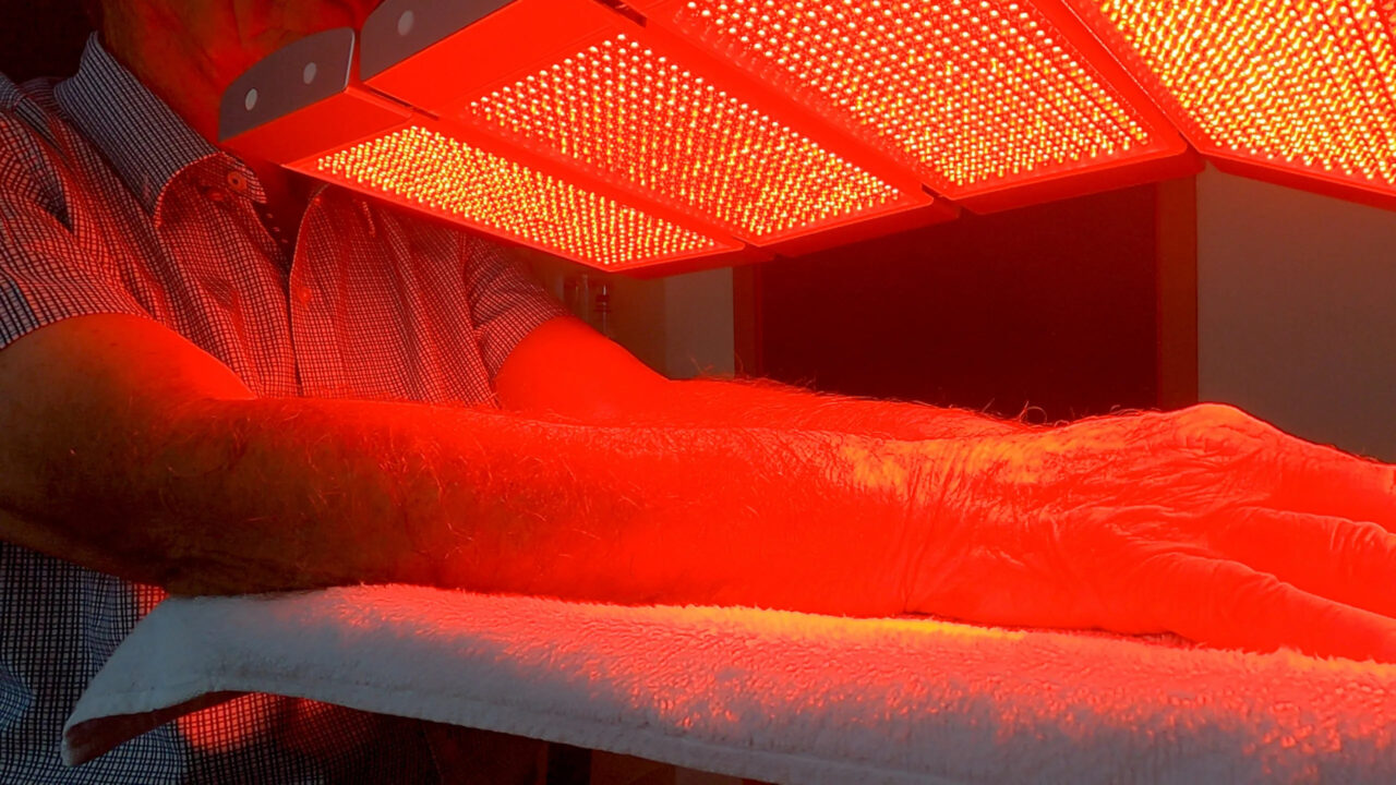 Red-light photodynamic therapy being applied to the forearms.