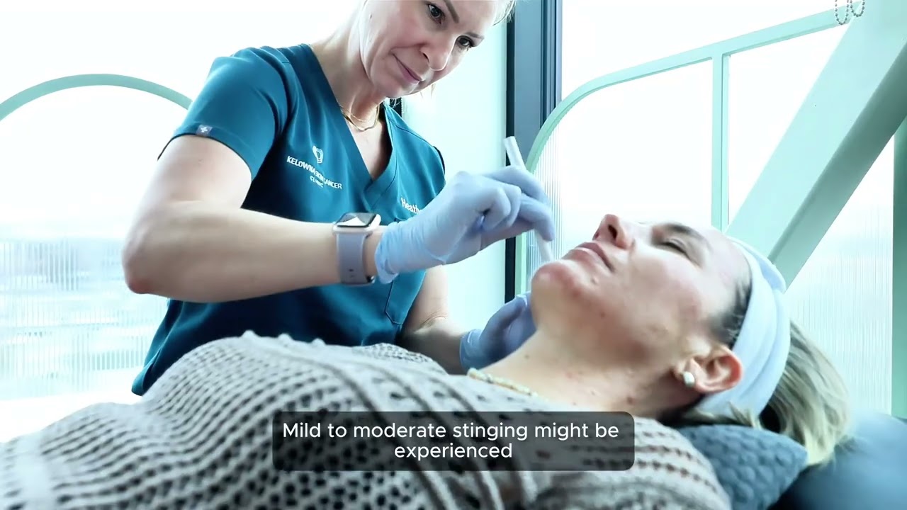 Microneedling-assisted Photodynamic Therapy — watch on YouTube (opens in a new tab)